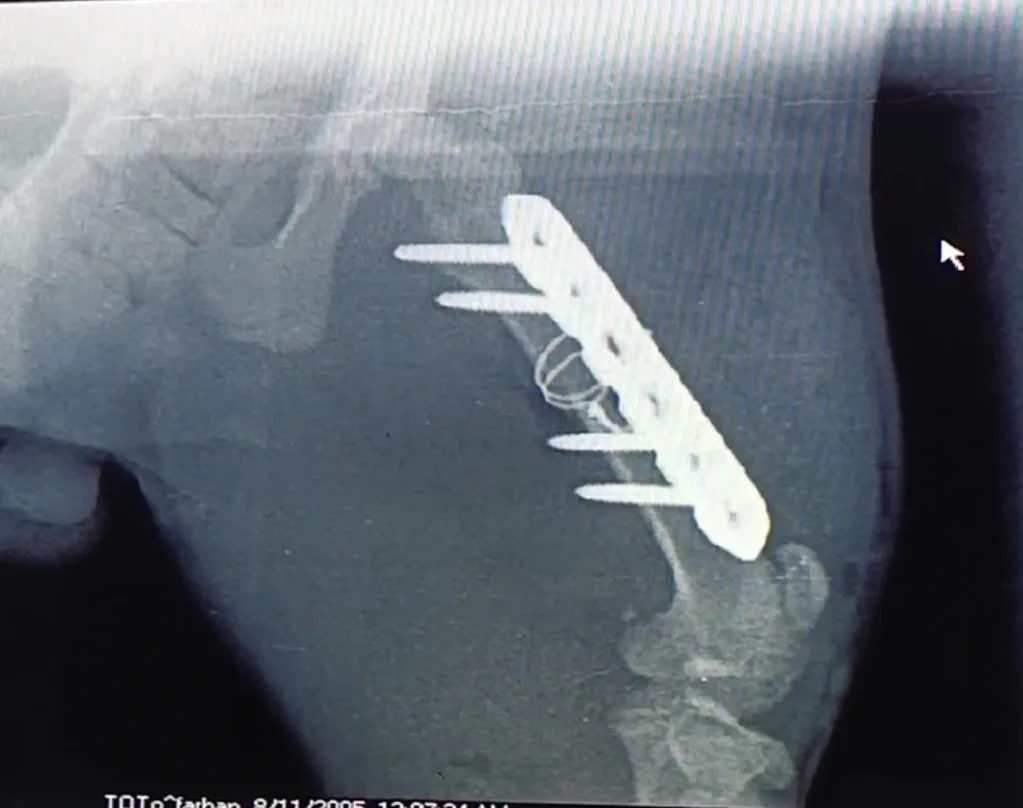 post operative x ray of a dog's thigh fixed with orthopedic plating and wiring.