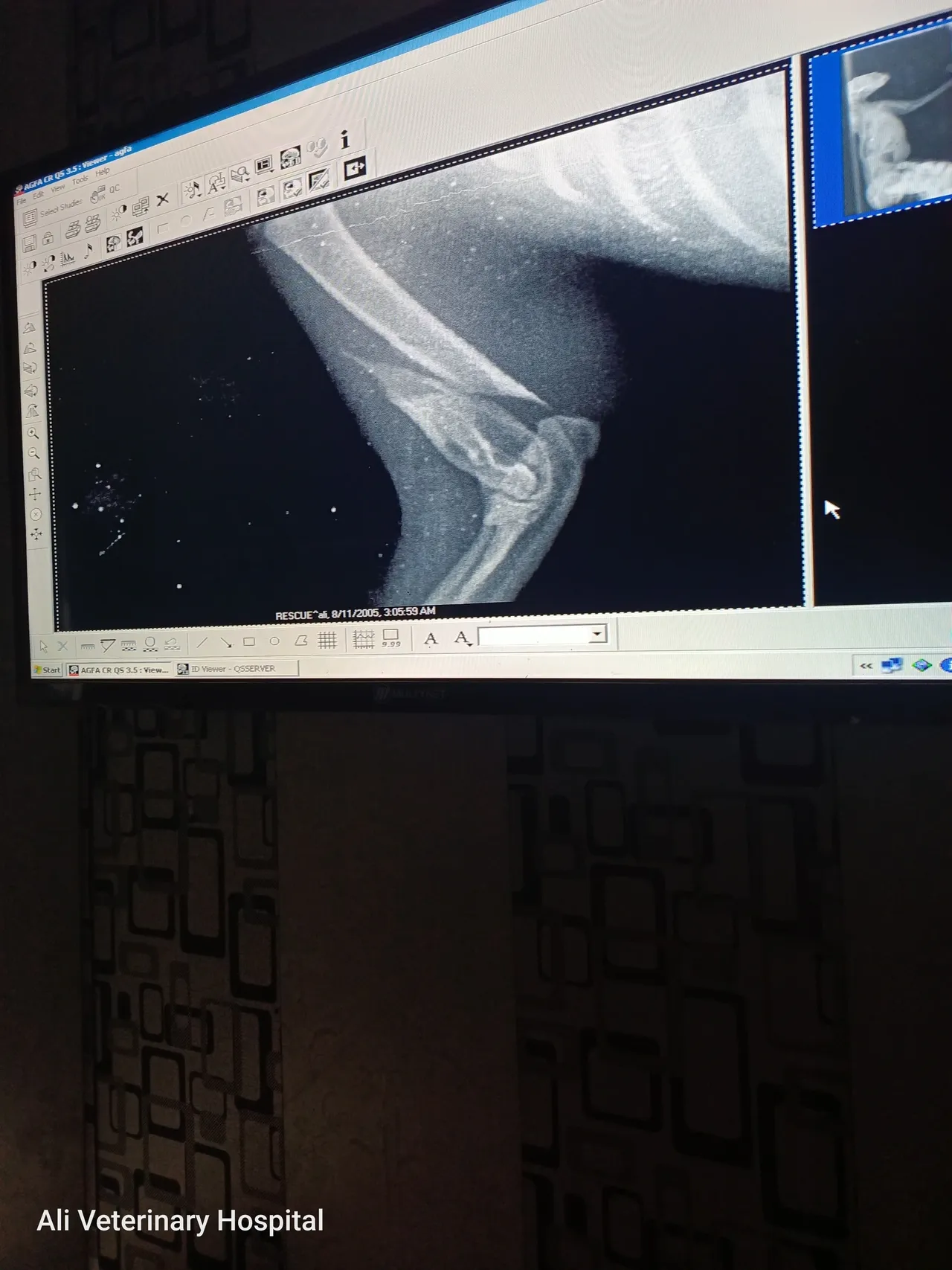 X Ray of a young kitten with oblique fracture of the forelimb due to a nasty fall.