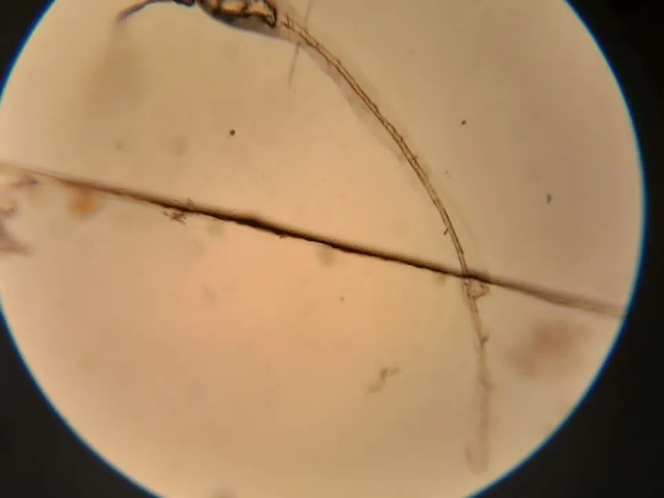 Microscopic image of a fungal hyphae from a cat