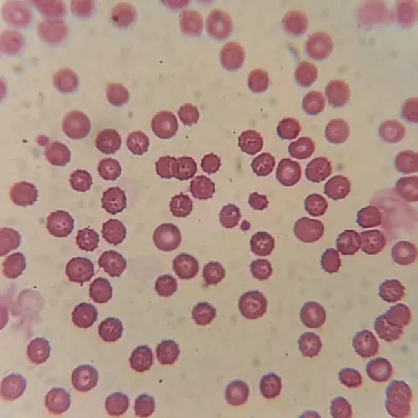 Micrograph of a cat's blood suffering from blood parasite infestation.