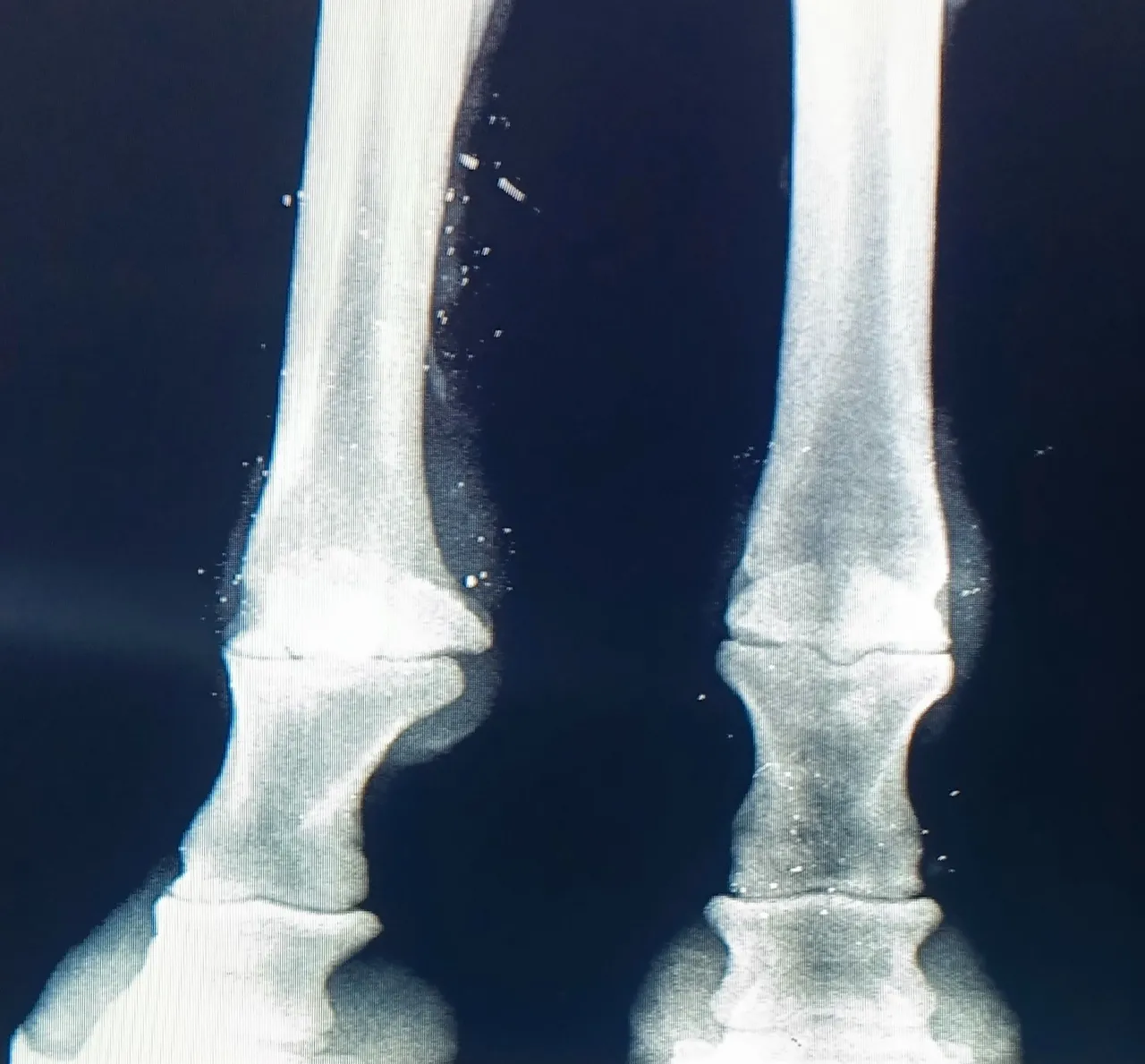 Digital X Ray image of a Spanish Stallion with mild lameness.